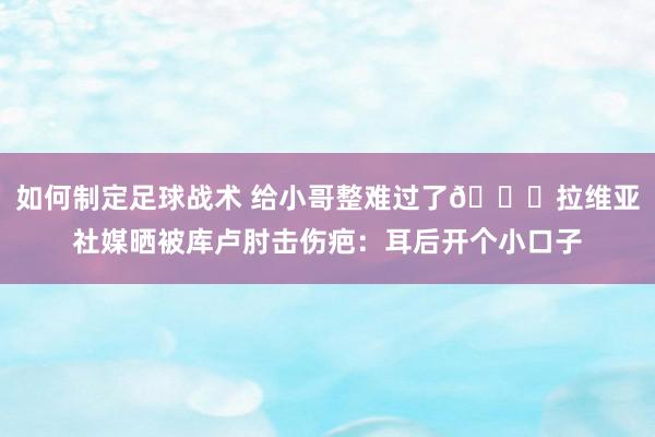 如何制定足球战术 给小哥整难过了😅拉维亚社媒晒被库卢肘击伤疤：耳后开个小口子