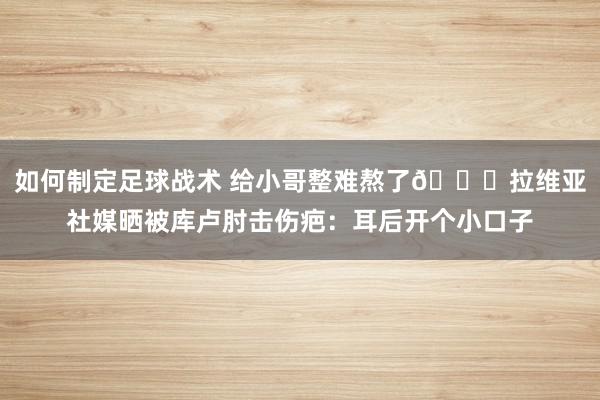 如何制定足球战术 给小哥整难熬了😅拉维亚社媒晒被库卢肘击伤疤：耳后开个小口子